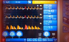 Od nowego roku respiratory mogą nie być już dostępne dla pacjentów w domach. Problem dotyczy kilkudziesięciu tysięcy chorych